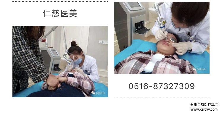 呂艷趁國慶假期，來我院接受激光手術(shù)治療