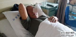 79歲老人患右腹股溝疝10多年，外科李素方主任1.5小時打了3個“小眼”給“補好”了……