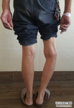 74歲老人換完關(guān)節(jié)要出院這天，“糾纏”了關(guān)節(jié)科主任半天……