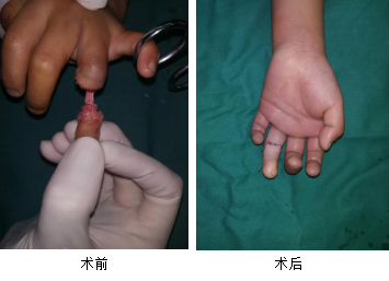 <a href='http://www.americasirondragons.com/' target='_blank'><u>徐州仁慈醫(yī)院</u></a>手外科